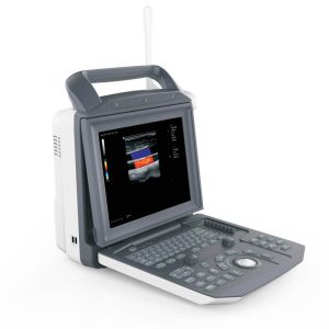 Portable Ultrasound System