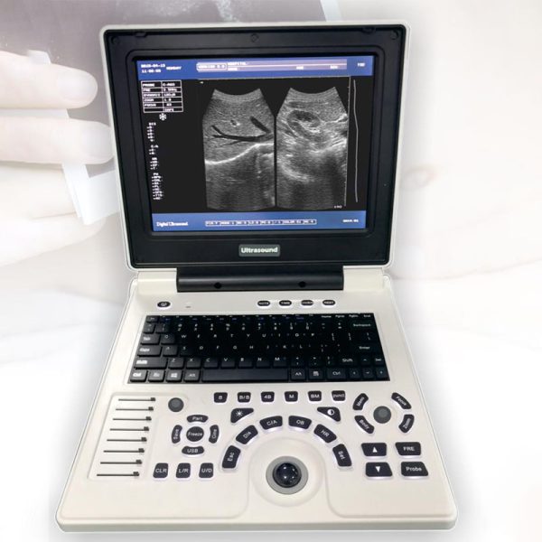 BW Notebook Ultrasound system