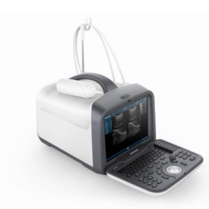 Portable Ultrasound System