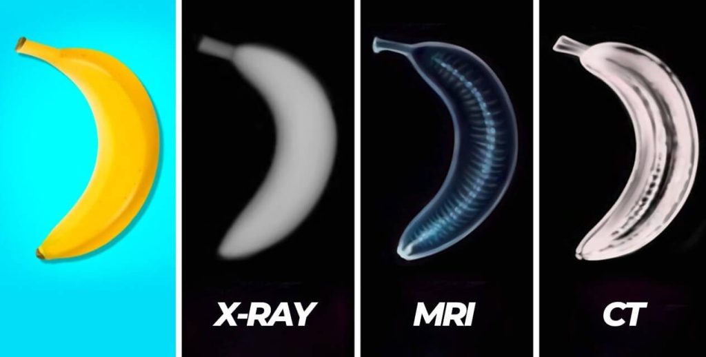 xray-mri-ct